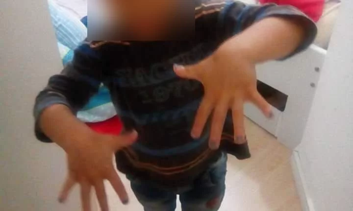 Professora pinta unha de menino de 4 anos em Florianópolis