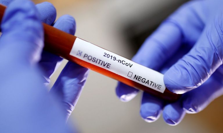 Itabira confirma primeiro caso de Covid-19 – Novo coronavírus